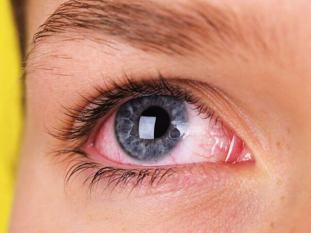 https://icaro.icaromediagroup.com/system/images/photos/16143286/original/open-uri20240403-18-ifkih0?1712182695
