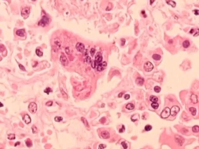 https://icaro.icaromediagroup.com/system/images/photos/16156265/original/open-uri20240410-74-k3gi2x?1712780270
