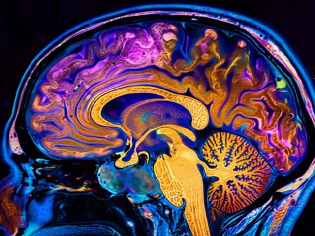 https://icaro.icaromediagroup.com/system/images/photos/16222704/original/open-uri20240521-56-17nhc0p?1716320575