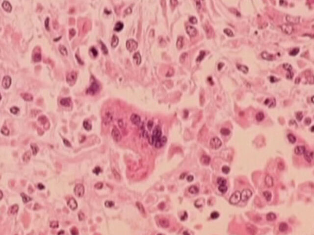https://icaro.icaromediagroup.com/system/images/photos/16241004/original/open-uri20240603-56-1dlz5qv?1717449795