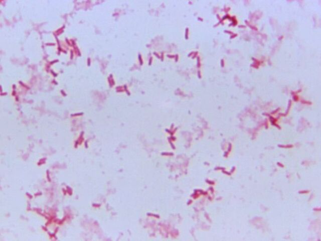 https://icaro.icaromediagroup.com/system/images/photos/16284281/original/open-uri20240705-56-1fw0k8r?1720209356